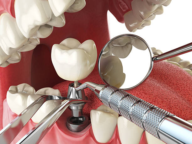 Best Emergency Dentist for Knocked-Out Tooth in Hazen, AR