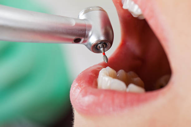 Best Emergency Root Canal Treatment in Hazen, AR